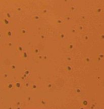 AMH109, gram positive with iodine stain showing behind these tiny rods